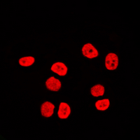 3 - Anti-BAF170 Antibody AP60051