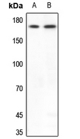 1 - Anti-BAF170 Antibody AP60051