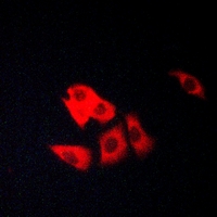 3 - Anti-Matriptase Antibody AP60053
