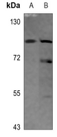 1 - Anti-Matriptase Antibody AP60053