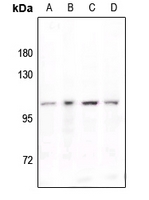 1 - Anti-STAT6 (Phospho-Y641) Antibody AP60056