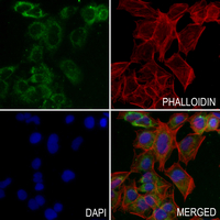 3 - Anti-ELOVL4 Antibody AP60057