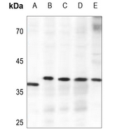 1 - Anti-ELOVL4 Antibody AP60057
