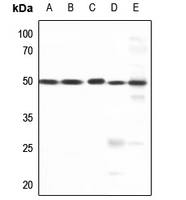 1 - Anti-AP2 gamma Antibody AP60060