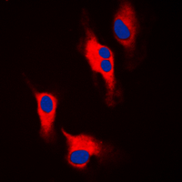 3 - Anti-Tyrosine Hydroxylase Antibody AP60061