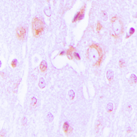 19 - Anti-Tyrosine Hydroxylase Antibody AP60061