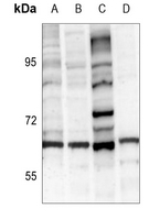 1 - Anti-Tyrosine Hydroxylase Antibody AP60061