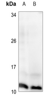 1 - Anti-Histone H4 (Phospho-S47) Antibody AP60064