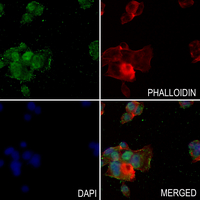 3 - Anti-p53 (Phospho-S33) Antibody AP60065