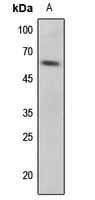 1 - Anti-p53 (Phospho-S33) Antibody AP60065