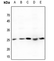 1 - Anti-Translin Antibody AP60066