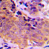 19 - Anti-VASP (Phospho-S157) Antibody AP60067