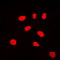3 - Anti-ZNF174 Antibody AP60069