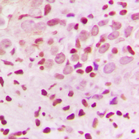 19 - Anti-ZNF174 Antibody AP60069
