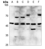 1 - Anti-ZNF174 Antibody AP60069