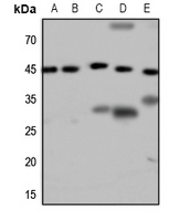 1 - Anti-GALR2 Antibody AP60072