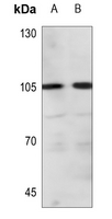 1 - Anti-ADAMTS1 Antibody AP60074