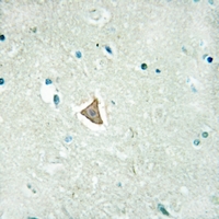 19 - Anti-ARMCX2 Antibody AP60076