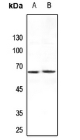1 - Anti-ARMCX2 Antibody AP60076