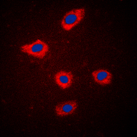 3 - Anti-MELK Antibody AP60077