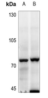 1 - Anti-MELK Antibody AP60077