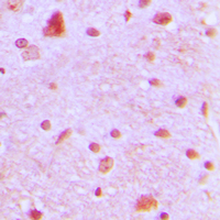 19 - Anti-ARNT2 Antibody AP60079