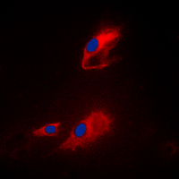 3 - Anti-ACOT8 Antibody AP60080