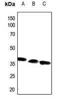 1 - Anti-ACOT8 Antibody AP60080