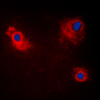 3 - Anti-TANK Antibody AP60081