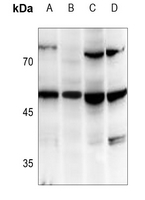 1 - Anti-TANK Antibody AP60081