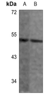 1 - Anti-ANGPTL7 Antibody AP60082