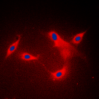 3 - Anti-LYPLA1 Antibody AP60085