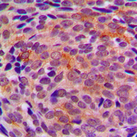 19 - Anti-LYPLA1 Antibody AP60085