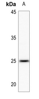 1 - Anti-LYPLA1 Antibody AP60085