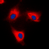 3 - Anti-14-3-3 theta/tau Antibody AP60089