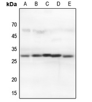 1 - Anti-14-3-3 theta/tau Antibody AP60089