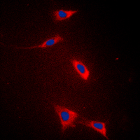 3 - Anti-FATP5 Antibody AP60091
