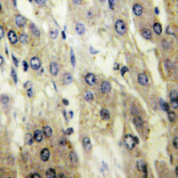 19 - Anti-FATP5 Antibody AP60091