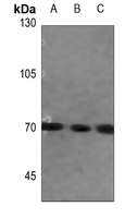 1 - Anti-FATP5 Antibody AP60091