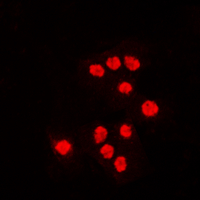 3 - Anti-ATF7 Antibody AP60092