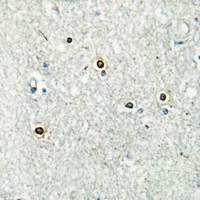 19 - Anti-ATF7 Antibody AP60092