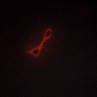 3 - Anti-AKAP10 Antibody AP60093