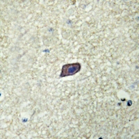 19 - Anti-AKAP10 Antibody AP60093