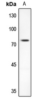 1 - Anti-AKAP10 Antibody AP60093