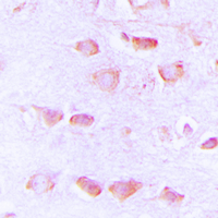 19 - Anti-Histamine H3 Receptor Antibody AP60094