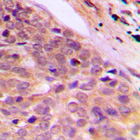 19 - Anti-Kanadaptin Antibody AP60095