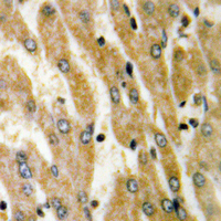 19 - Anti-ACSL6 Antibody AP60096