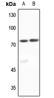 1 - Anti-ACSL6 Antibody AP60096