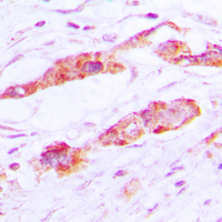 19 - Anti-CLIC4 Antibody [KO/KD Validated] AP60098