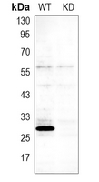 0 - Anti-CLIC4 Antibody [KO/KD Validated] AP60098